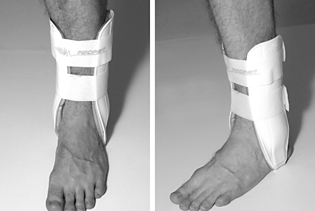 Ankle Taping Vs Bracing