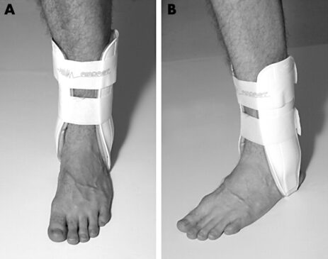 Ankle Taping Vs Bracing